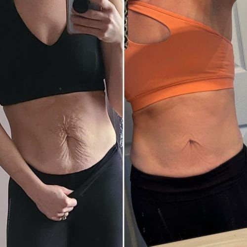 ELVIRA™ - Alakápoló Készülék