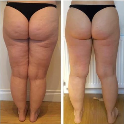 ELVIRA™ - Alakápoló Készülék