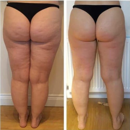 ELVIRA™ - Alakápoló Készülék